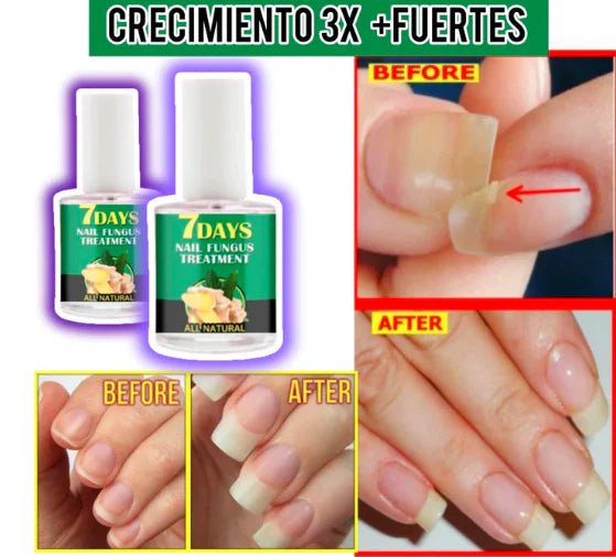 7 DAYS NAILS endurecedor de uñas (2)